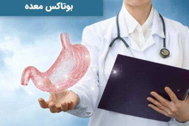 بوتاکس معده یکی از روش های لاغری می باشد