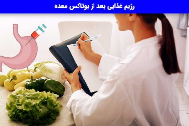 رژیم غذایی بعد از بوتاکس معده