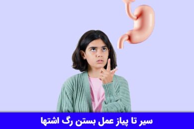 بستن رگ اشتها