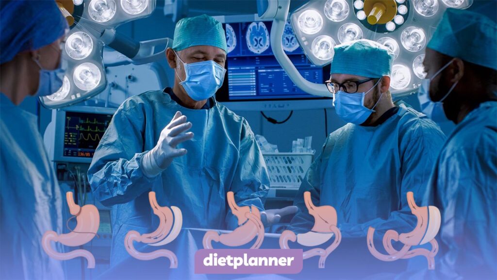 تسلط بر انواع روش های جراحی لاغری