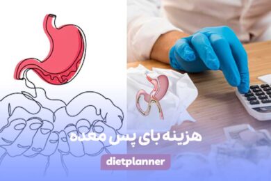 هزینه بای پس معده