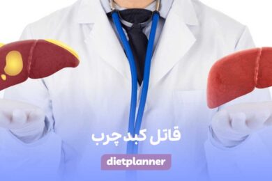 قاتل کبد چرب