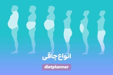 انواع چاقی