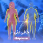 چاقی ارثی