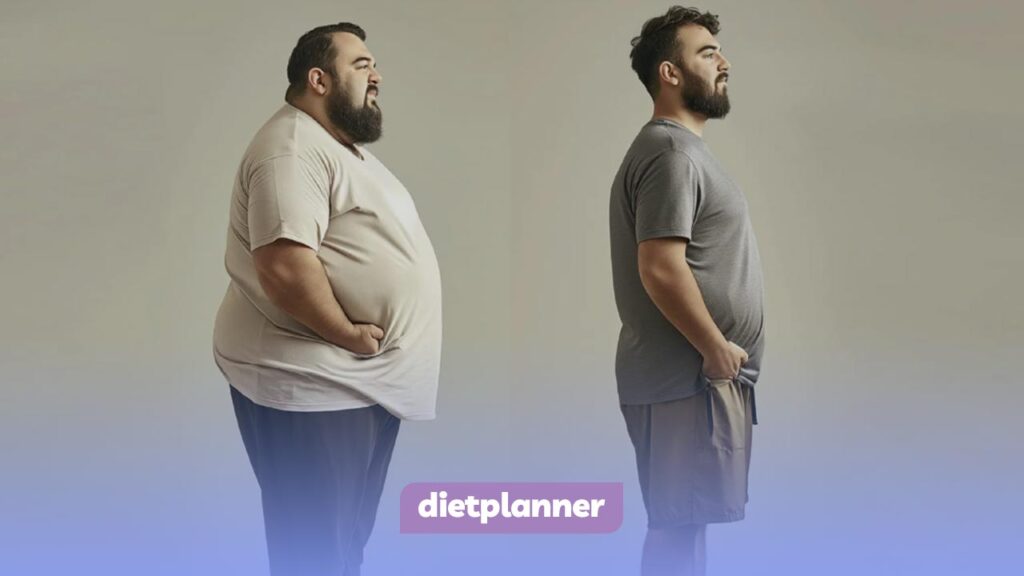 مزایای انجام جراحی لاغری